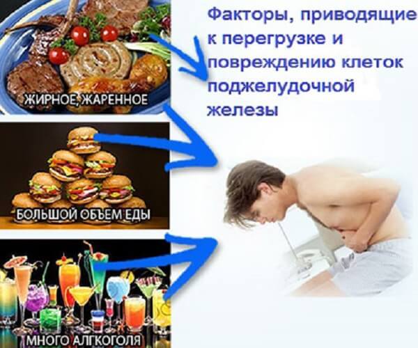 Стеатоз поджелудочной железы: Что делать, если железа начинает перерождаться в жир Стеатоз поджелудочной железы: Что делать, если железа начинает перерождаться в жир