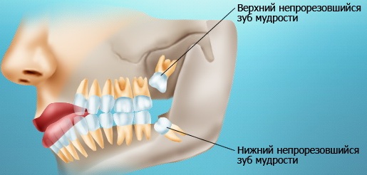 Прорезывание зубов